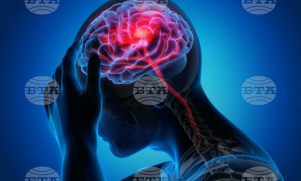 Учените откриха начин за справяне с мигрената