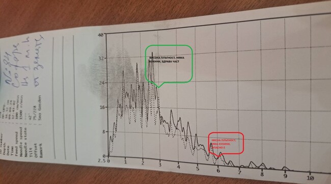 Община Варна: Близо 140 дървета в градината зад театъра са обследвани за кухини и заболявания