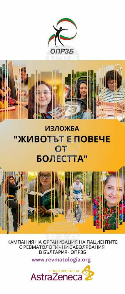 Изложбата "Лупус: Животът е повече от болестта“ ще бъде представена в София