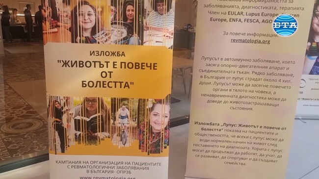 Пациенти с лупус се включиха в изложба с фотографии под надслов „Лупус: Животът е повече от болестта“