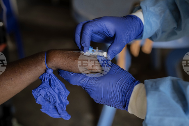 СЗО свика комисия за повторна оценка на глобалната заплаха за здравето от маймунската шарка